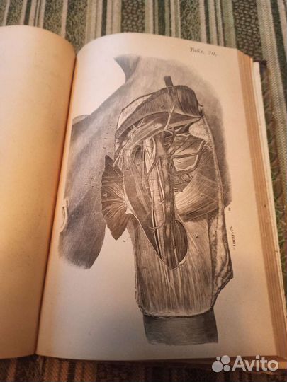 Антикварная книга по медицине 19век