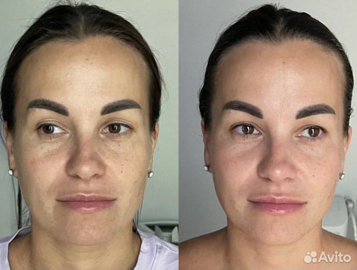 Хиромассаж лица