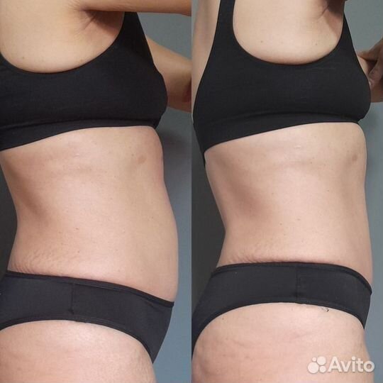 LPG массаж vela shape