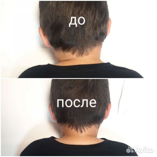 Акупрессура мышц затылка, шеи и тд от