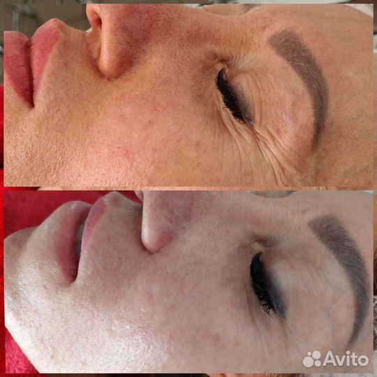 Косметолог с мед. образованием