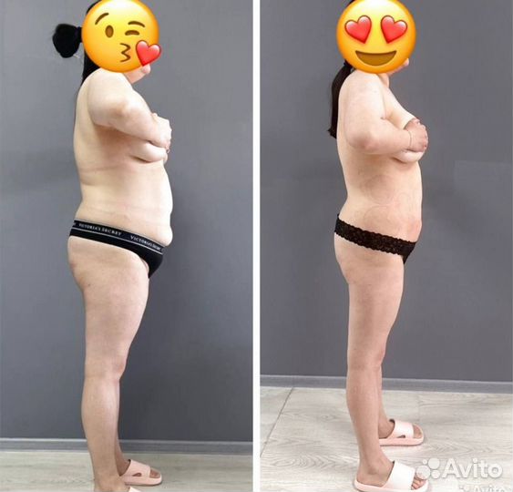 Аппаратный массаж. Антицеллюлитный. Коррекция фигу