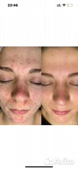 Косметолог иньекцыонист