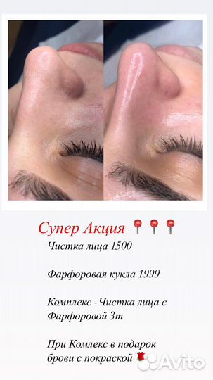 Услуги косметолога чистка лица Брови