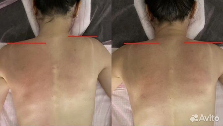 Массаж лица и тела Остеопластика