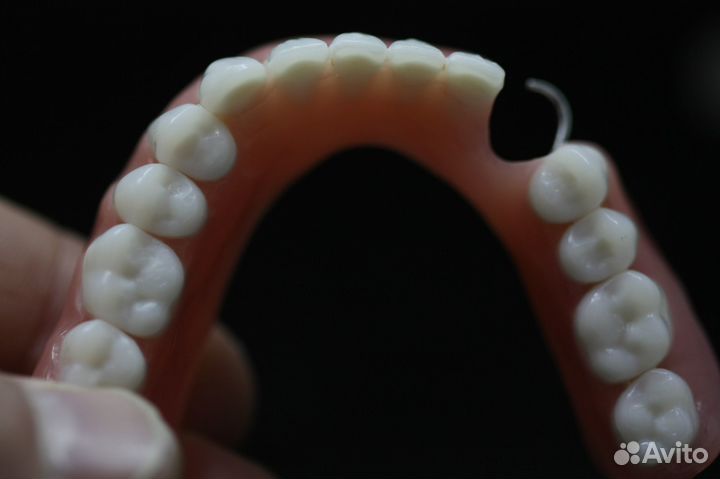 Частичный съемный протез