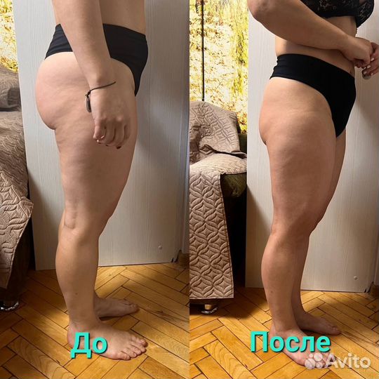 Массаж Профессионал