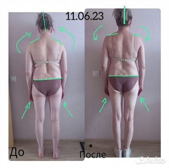 Профессиональный, оздоровительный массаж