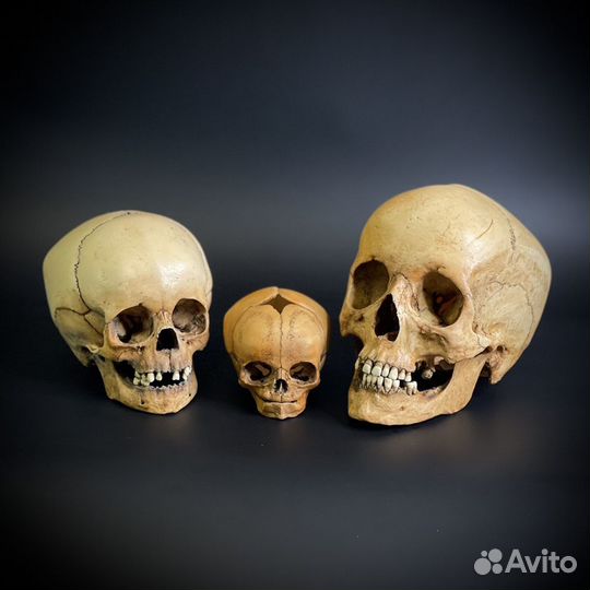 Череп анатомический - набор из трёх черепов