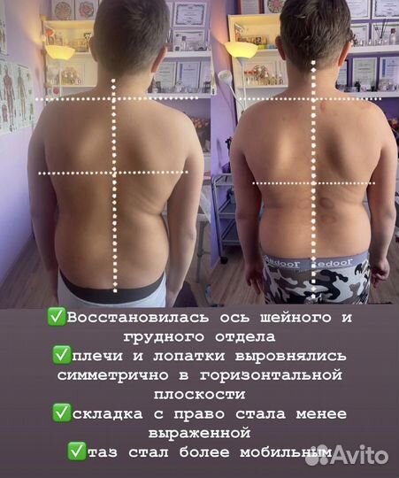 Массажист,костоправ,хиропрактик