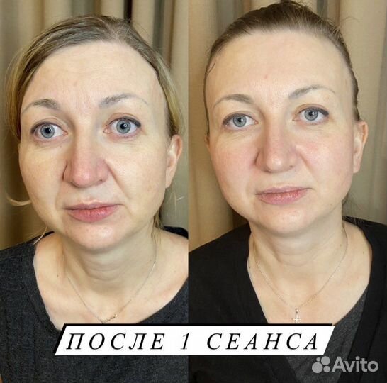 Миофасциальный массаж лица и головы