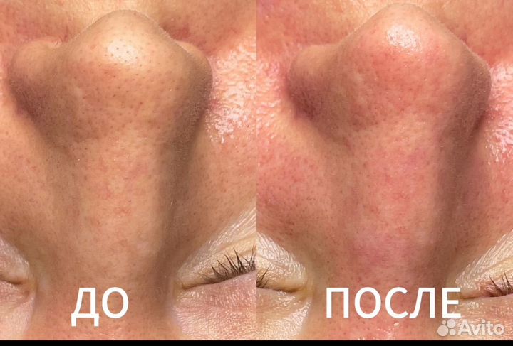 Косметолог пятигорск