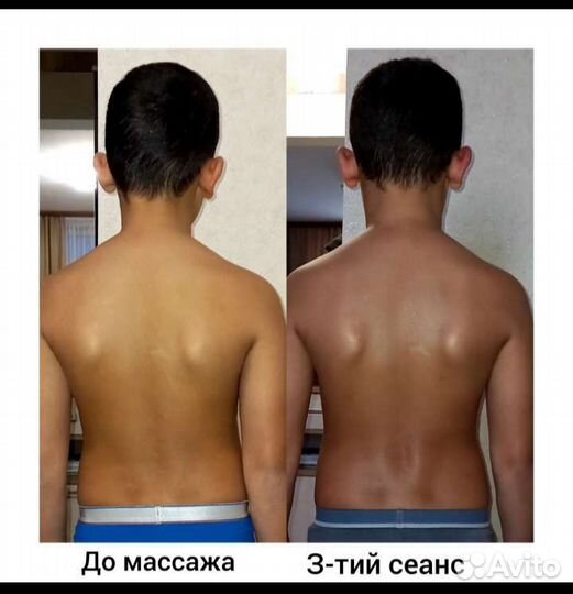 Детский массаж