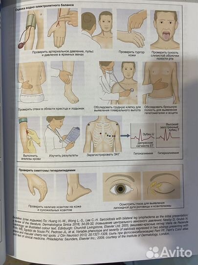 Внутренние болезни по дэвидсону