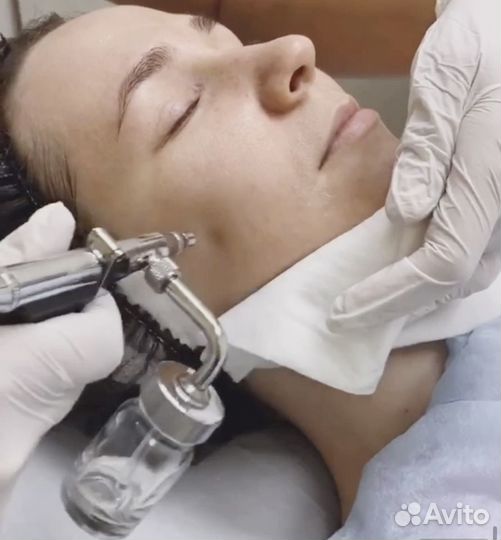 Косметологический аппарат Skindex