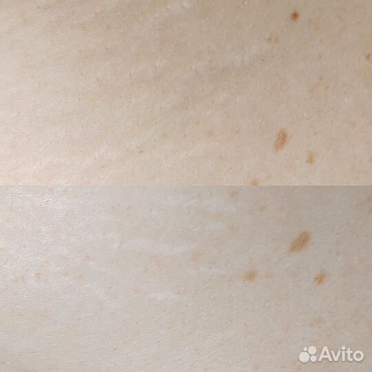 Холодная плазма