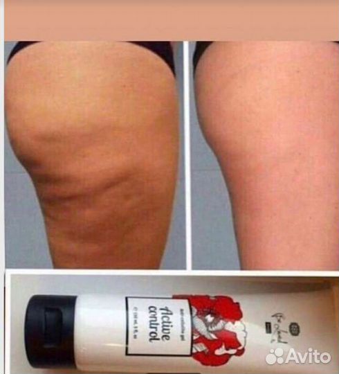 Антицеллюлитнный разогреваюший гель для тела