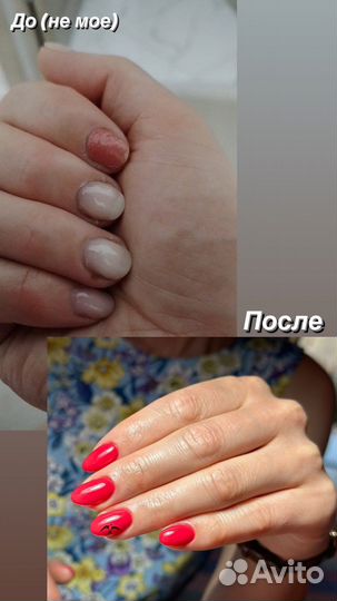 Наращивание и покрытие ногтей
