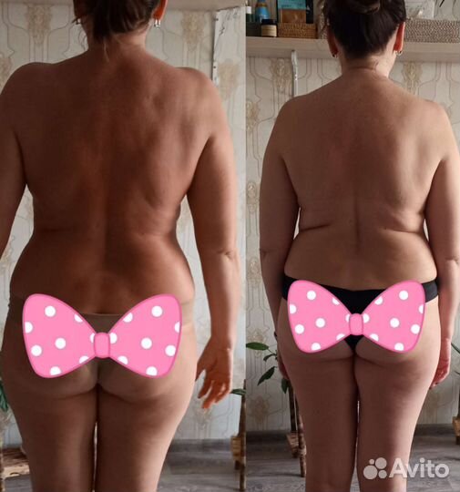 Массаж лица и тела(медицинское образование)