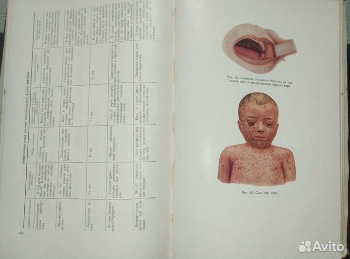 Учебник детских болезней.Медгиз 1958г.ссср