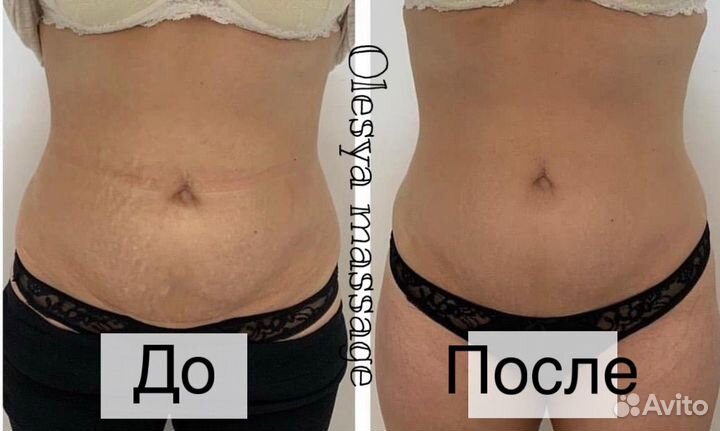 Массаж аппаратный,для похудения