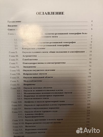 Магнитно-резонансная томография головного мозга