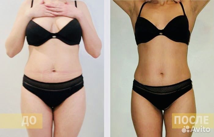 Скраб для тела