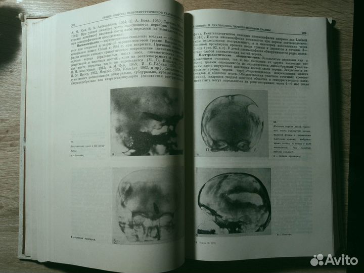 Руководство по нейротравматологии