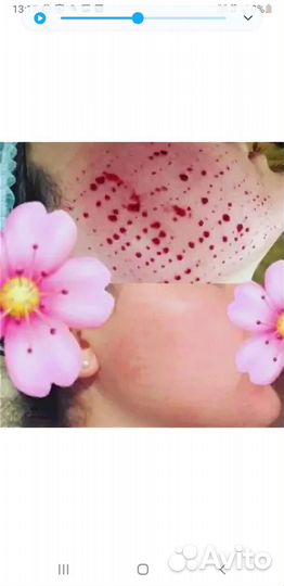 Массаж Жен.п