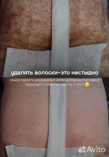 Шугаринг, восковая депиляция