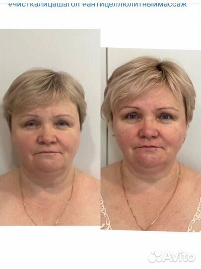 Массаж лица и тела все виды массажа