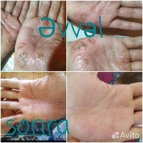 Сибирское здоровье