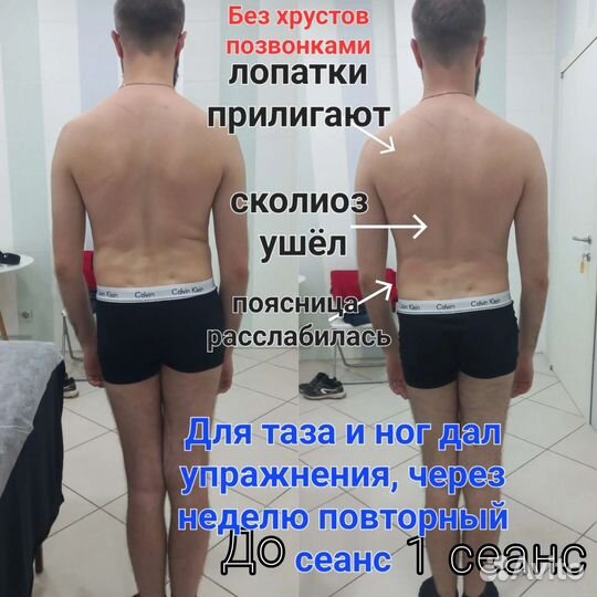 Массаж кинезио, Здоровая спина, Восстановление