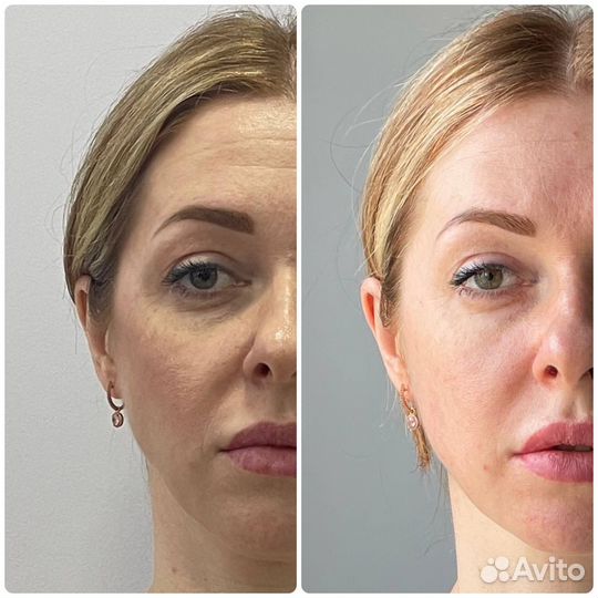 Косметология лица