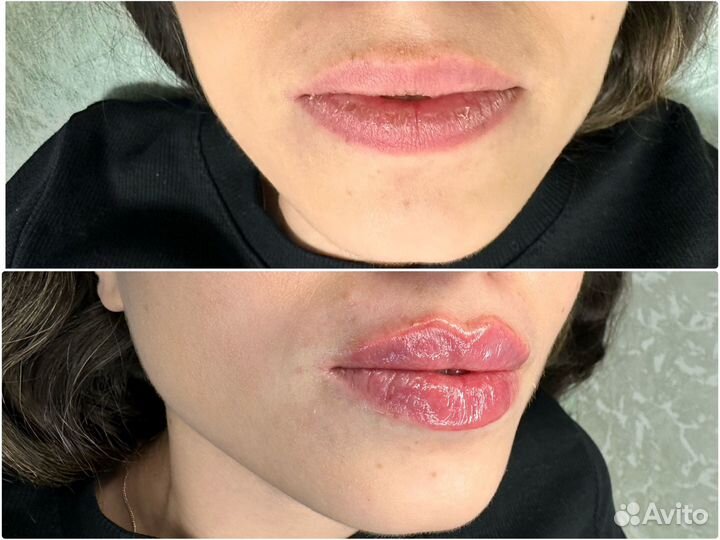 Обучение современной косметологии