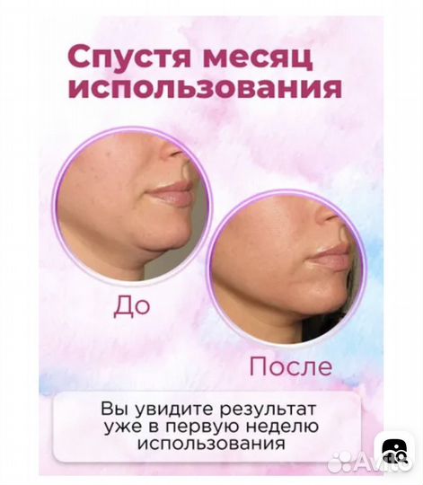 Тренажер для мышц лица и второго подбородка