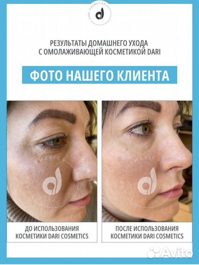 Крем суфле омолаживающий dari cosmetics