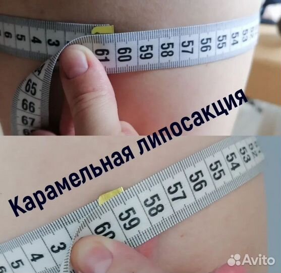 Массаж. Карамельная липосакция. Массаж лица