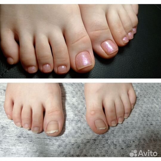 Маникюр, педикюр на дому