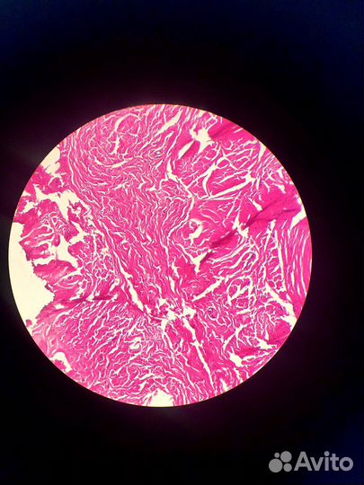 Изготовление гистологических препаратов