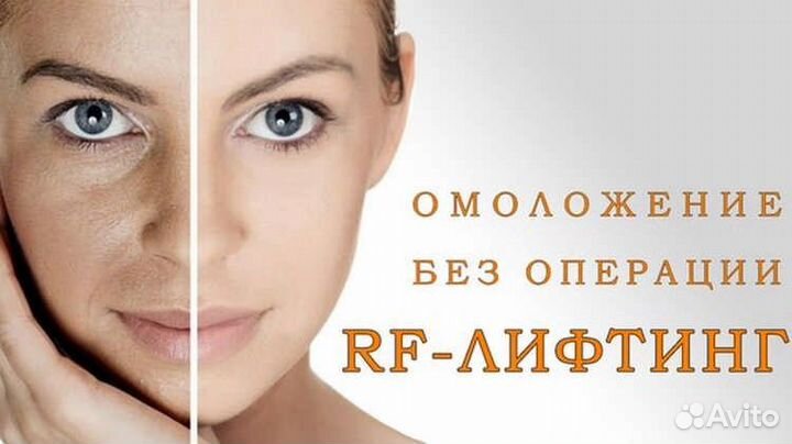 Микроигольчатый RF лифтинг