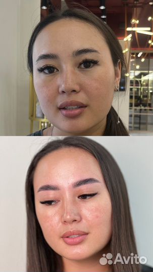 Брови, ресницы