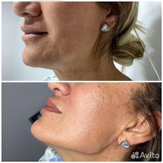 Услуги косметолога