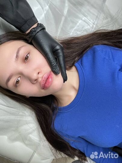Увеличение губ