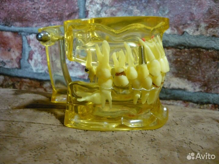 Демонстрационная модель зубов,Патологии