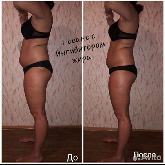 Антицеллюлитный массаж