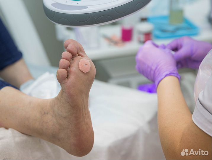 Медицинский педикюр - Подолог