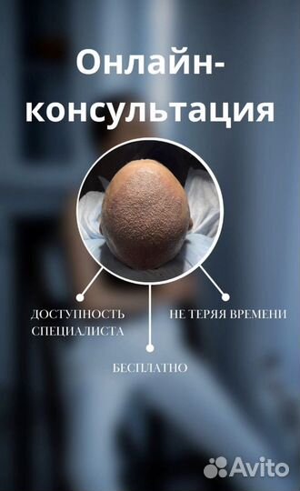 Пересадка волос в Казани