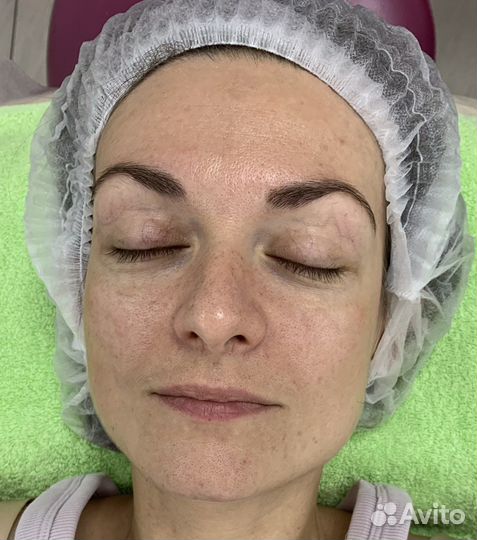 Косметолог/чистка/ пилинг/масаж