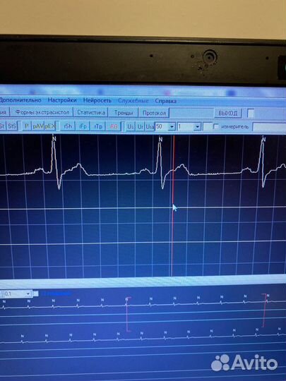 Холтер монитор